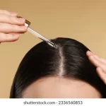 全面拆解藥物保康丝優點：生髮效果、安全性與長期效益一文看清